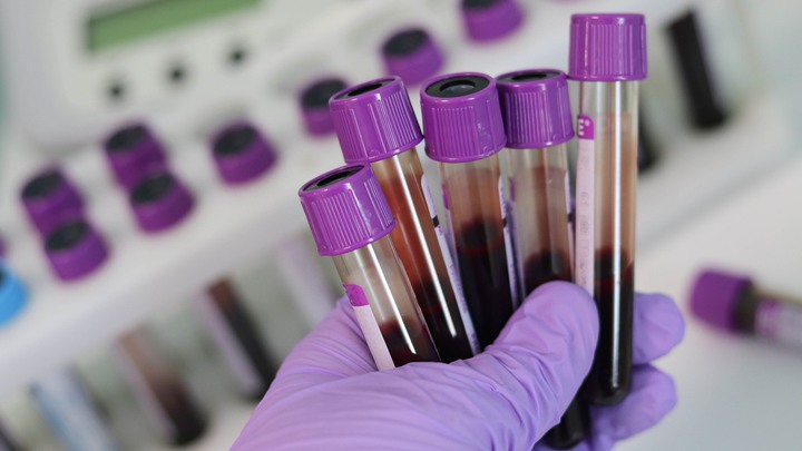 Hand håller provrör med blod